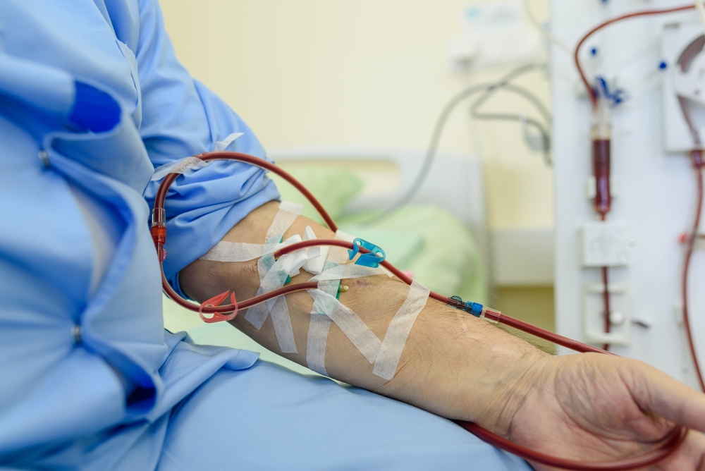dialysis catheter connected to a vein in a hospital