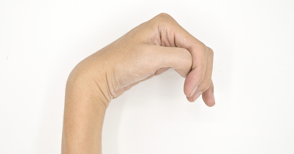 What Causes Hemiplegia? Treatment Options for Partial Paralysis