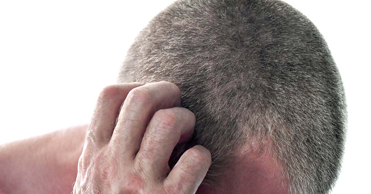 9 Possible Causes of Scalp Bumps (And When to Worry)