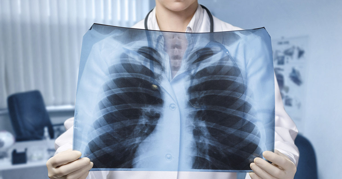 The Ability to Reverse Damage to Your Heart and Lungs is Closer Than You Think