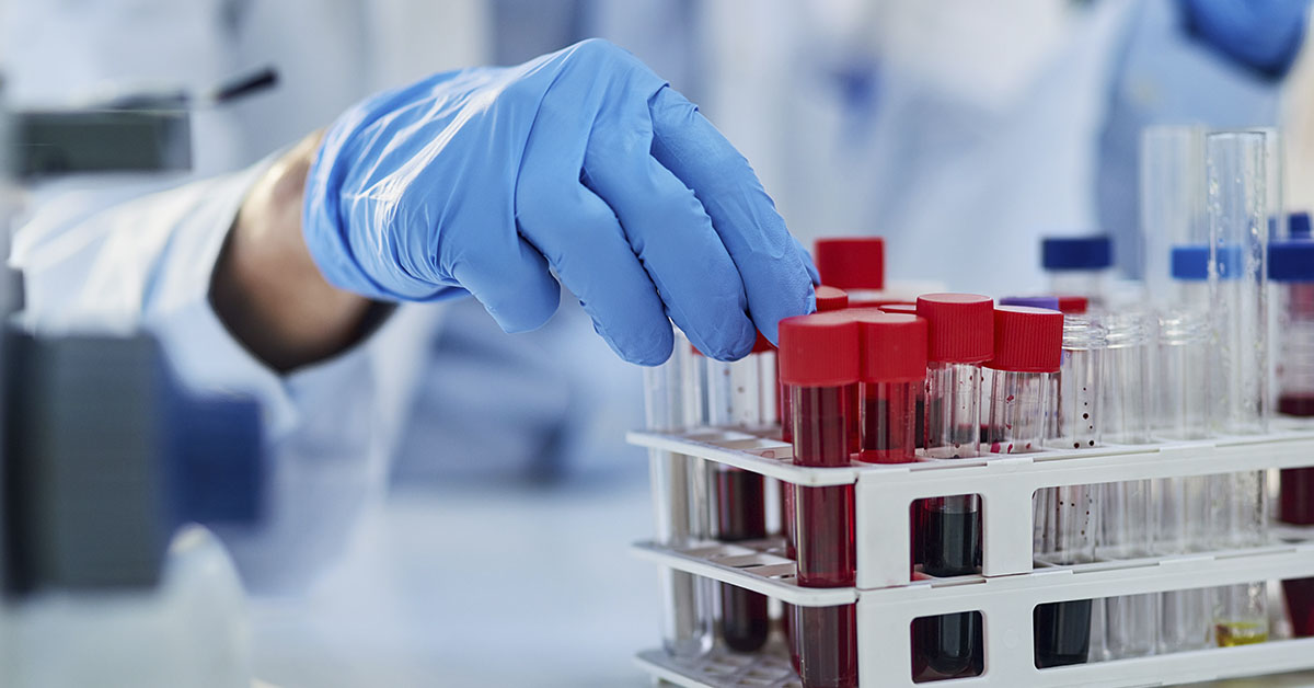 A Simple Blood Test May Help With The Early Detection of 14 Cancers