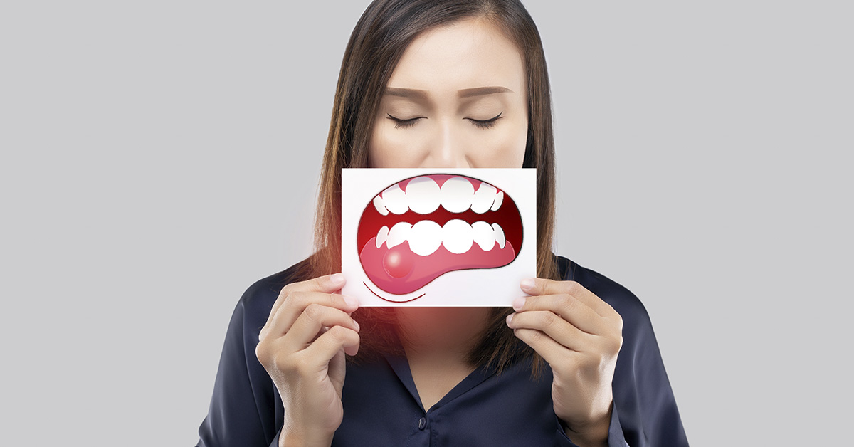 Mouth Cancer: Symptoms, Signs, and When to See a Doctor