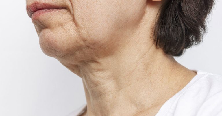 Is The Skin On Your Neck Starting To Sag? Here’s Why And What To Do About It - Featured image