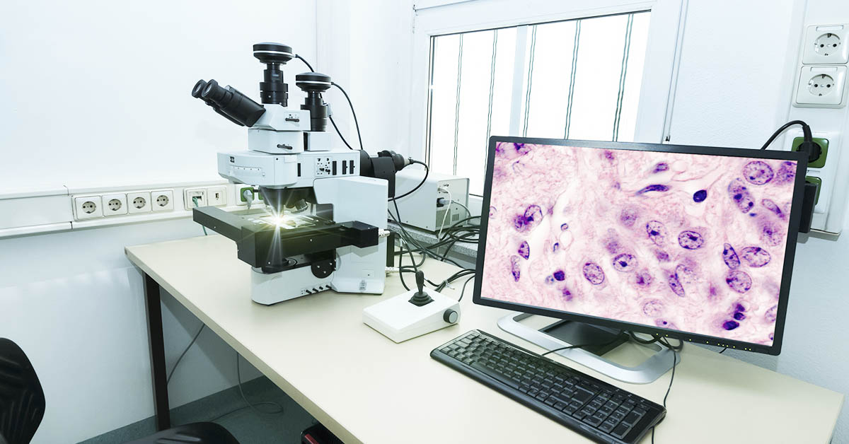 Scientists Show Early Promise in Reversing Parkinson’s Symptoms Using Lab-Grown Brain Cells