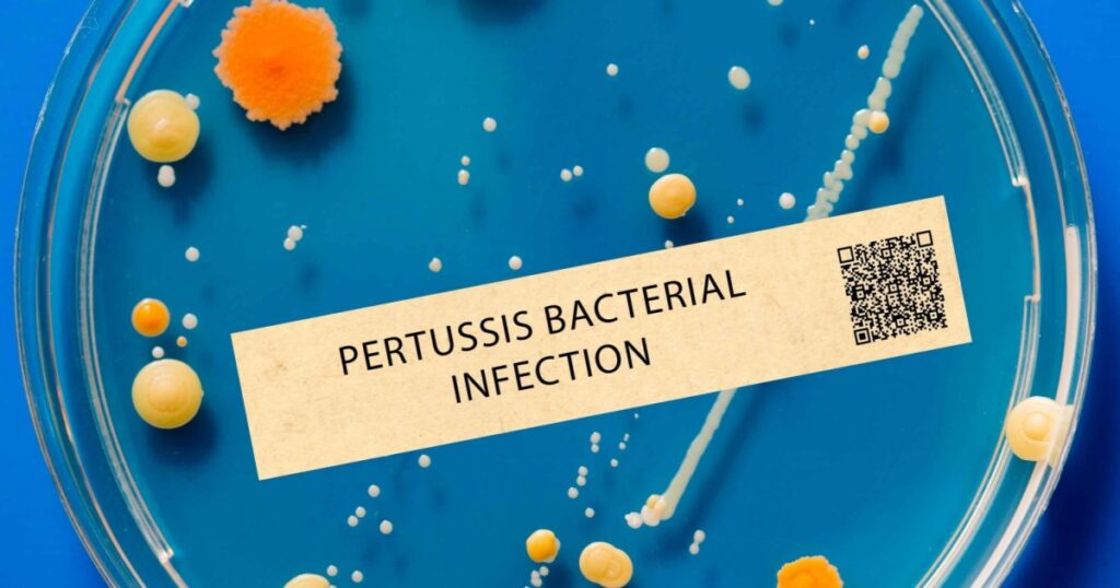 Infant Death Highlights Severity of Australia’s Worst Whooping Cough Epidemic On Record - Featured image