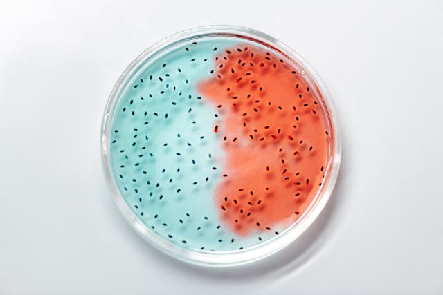 E. Coli