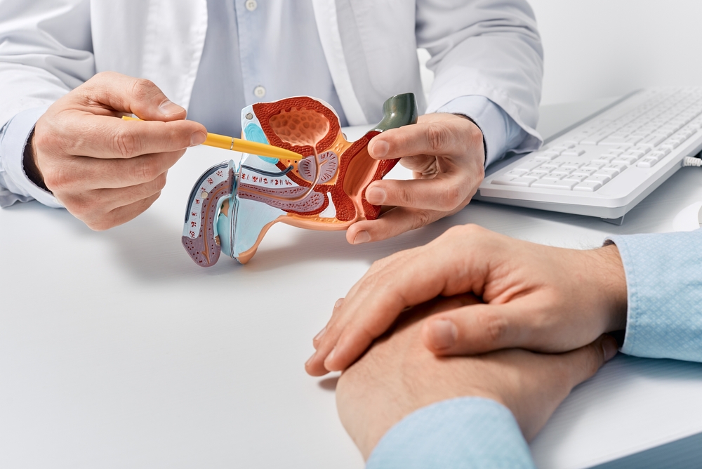 Prostate disease and treatment. Male reproductive system anatomical model in doctors hands close-up during consultation of male patient with suspected bacterial prostatitis
