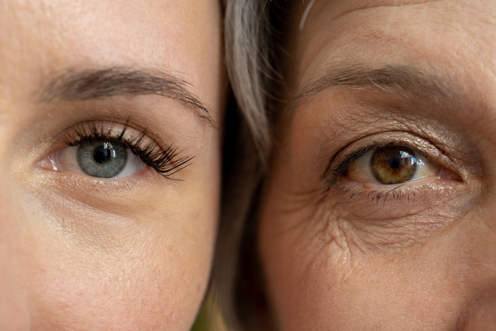 A close-up comparison of the eyes of a young woman and an older woman, highlighting the visible differences in skin texture and wrinkles
