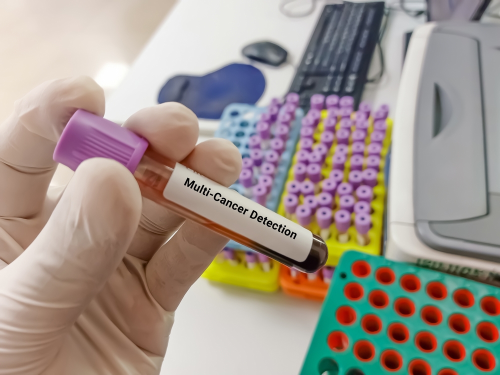 Scientist hold blood sample for Multi cancer Detection (MCED) test. Healthcare and medical test concept.