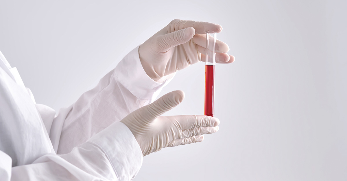 How Your Blood Type May Affect Your Risk of Heart Disease: What You Should Know
