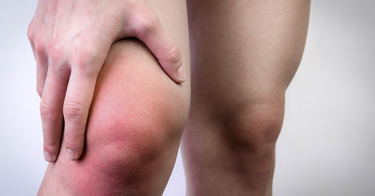 7 Causes of a Swollen Knee and When to See a Doctor