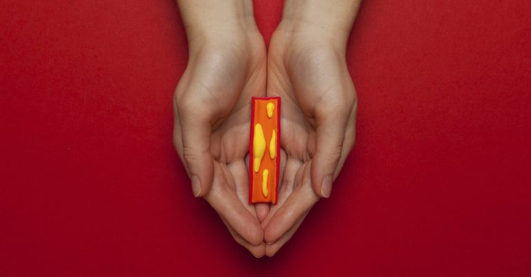 How to Recognize and Fight Clogged Arteries: Signs, Prevention, and Treatment Strategies - Featured image
