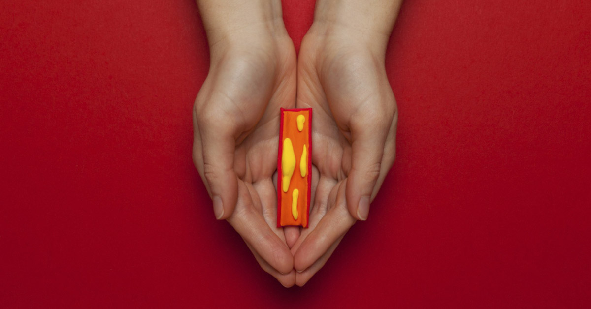 How to Recognize and Fight Clogged Arteries: Signs, Prevention, and Treatment Strategies