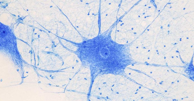 Study Confirms Adults Can Grow New Brain Cells, and They Found the Source - Featured image