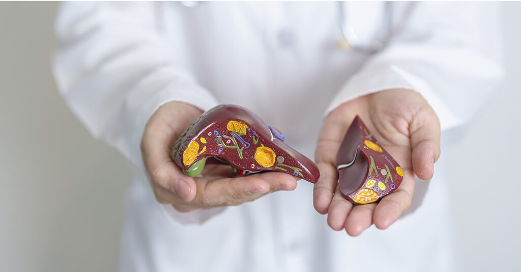 The Link Between Vitamin D Deficiency and Fatty Liver - Featured image