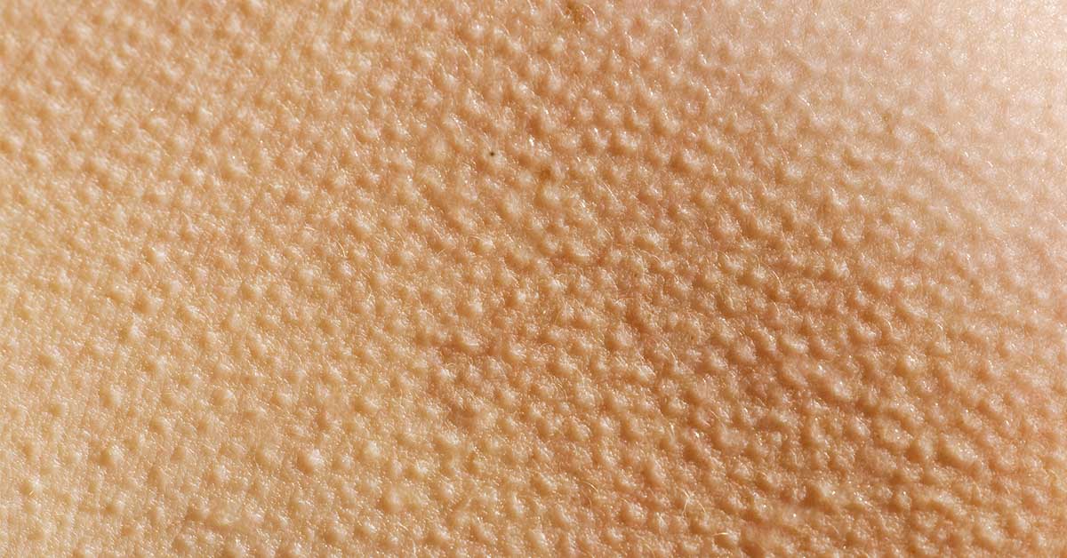 New Body Modification Method ‘Freeze Branding’ Raises Alarms Over Lasting Harm