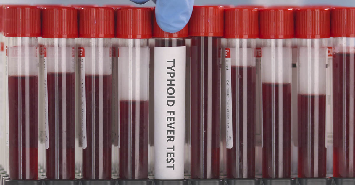 Deadly Ancient Illness Is Making a Global Comeback