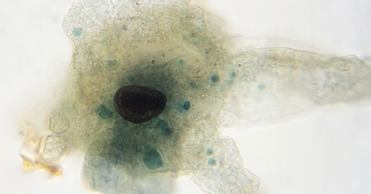 Tap Water Nasal Rinse Turns Into Nightmare as Brain-Eating Amoeba Kills Texas Woman