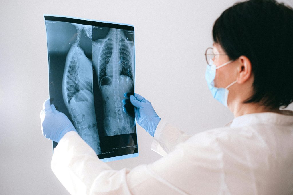 A Doctor Holding an X-ray Result
