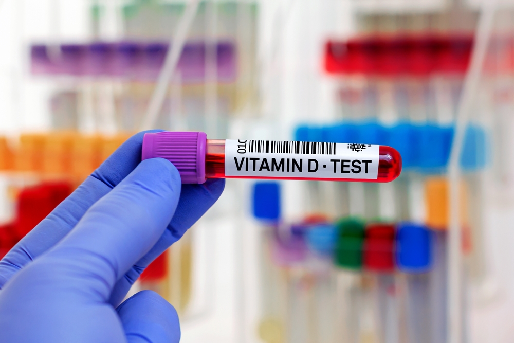 Blood sample of patient for Vitamin D test in laboratory. Hand doctor with Blood tube for Vitamin D test