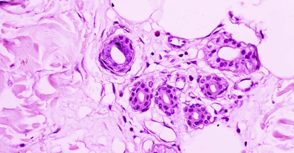 Respiratory Infections May Activate Dormant Cancer Cells - Featured image