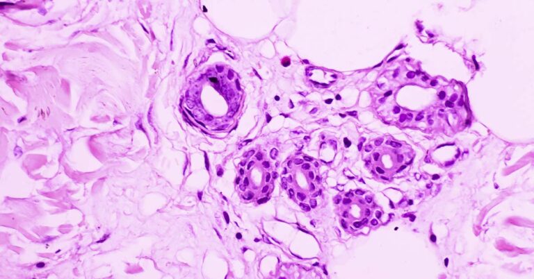 Respiratory Infections May Activate Dormant Cancer Cells - Featured image