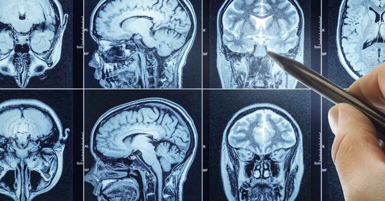 The Walking Dead Actress Kelley Mack Dies at 33 — What to Know About Her Rare Brain Cancer - Featured image