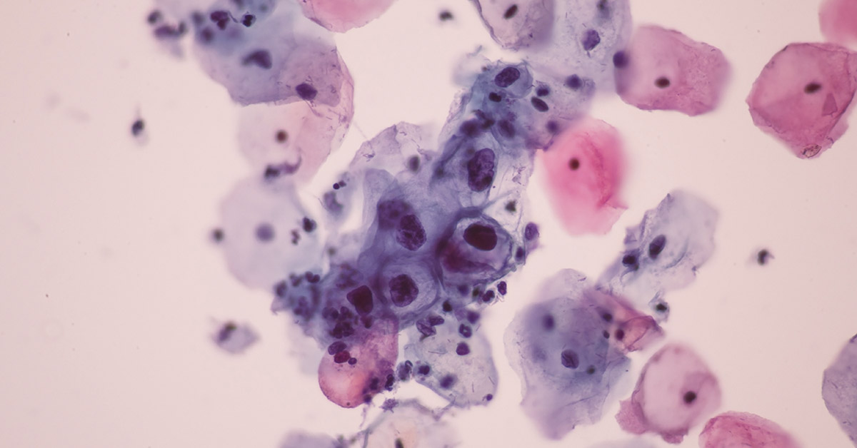 Infected ‘Frankenstein’ Rabbits With Tentacles Spotted in the US, Phenomena Explained