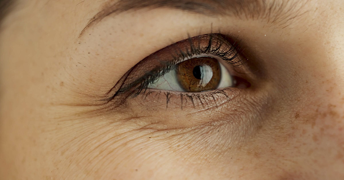 10 Easy Ways to Prevent Wrinkles – No Matter Your Age
