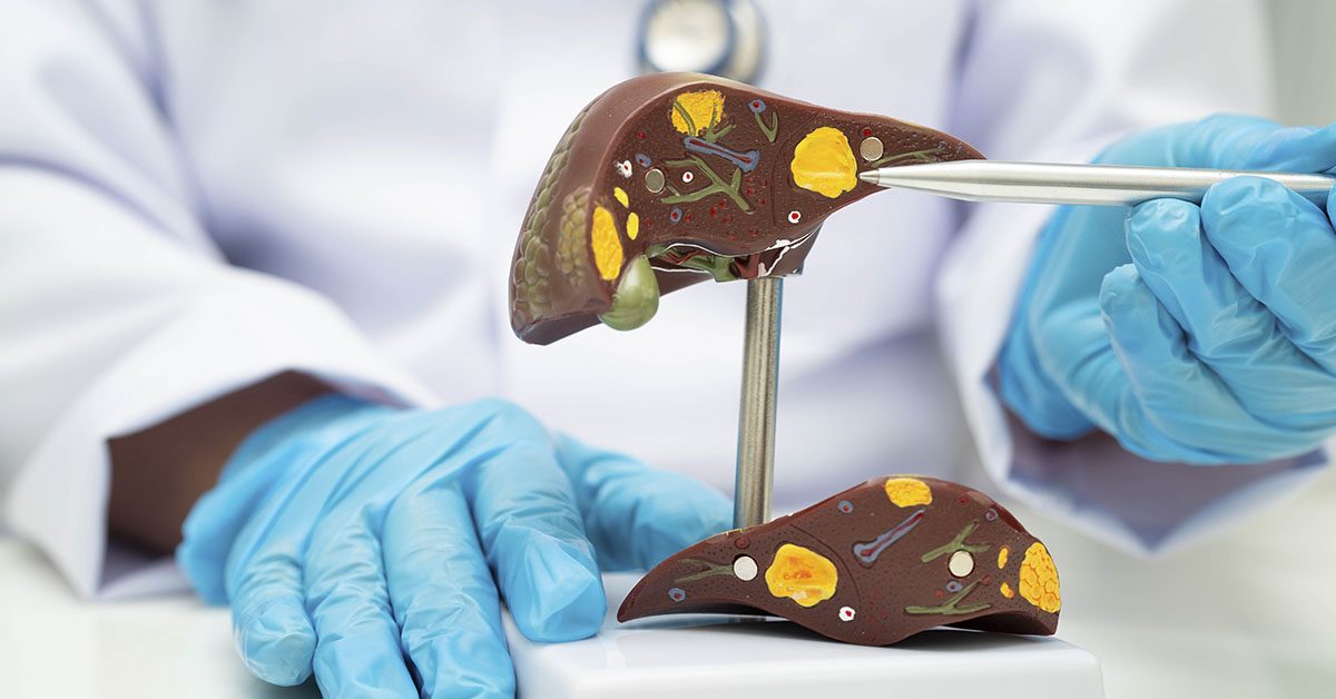 Harvard Doctor Recommends 4 Weekly Snacks to Combat Fatty Liver