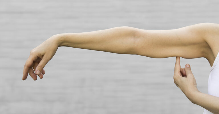What Is Sarcopenia? Causes, Risk Factors, and How to Manage It - Featured image