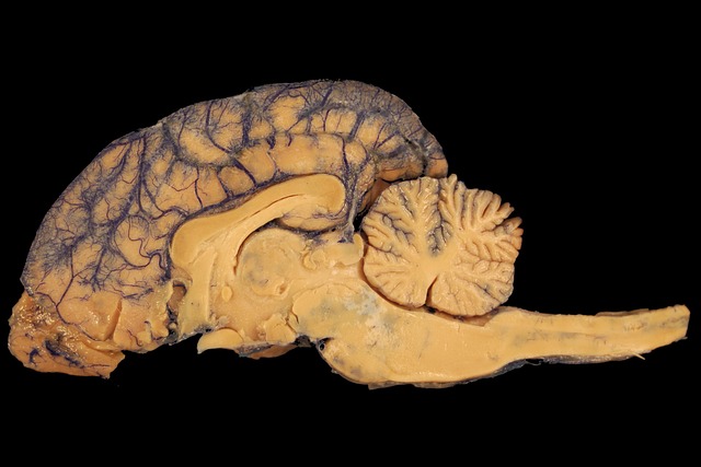 brain