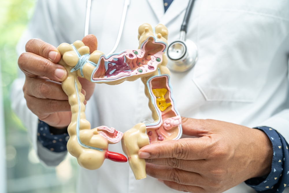 Intestine, appendix and digestive system, doctor holding anatomy model for study diagnosis and treatment in hospital.
