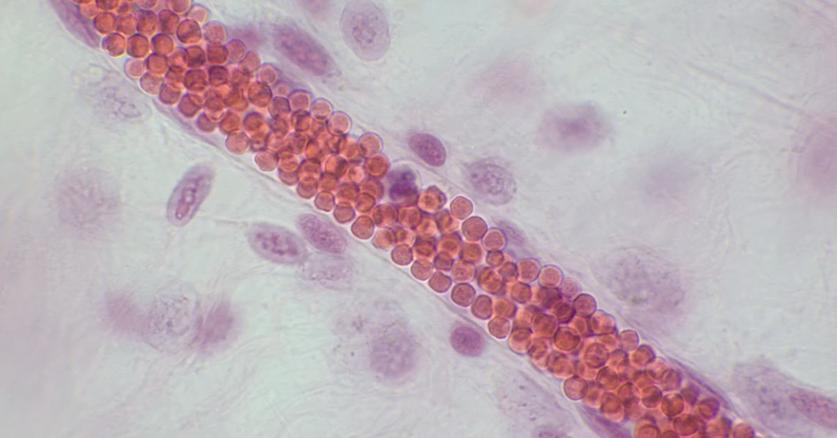 12 Foods That Could Help Reduce Blood Clot Risk (And Some to Avoid)