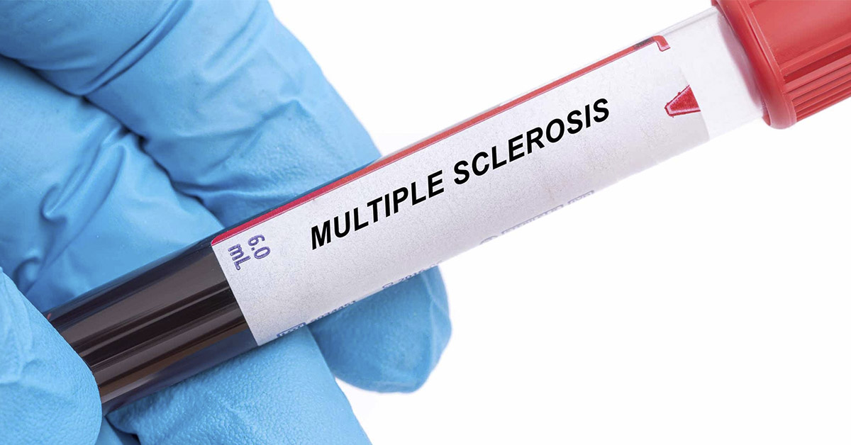 Study Points to Two Bacteria as Possible Causes for Multiple Sclerosis