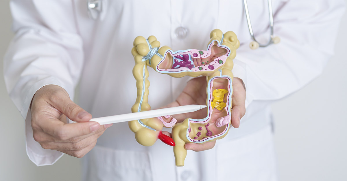 Doctor Warns Gen Z: ‘Silent’ Signs of Bowel Cancer May Go Unnoticed as Cases Rise