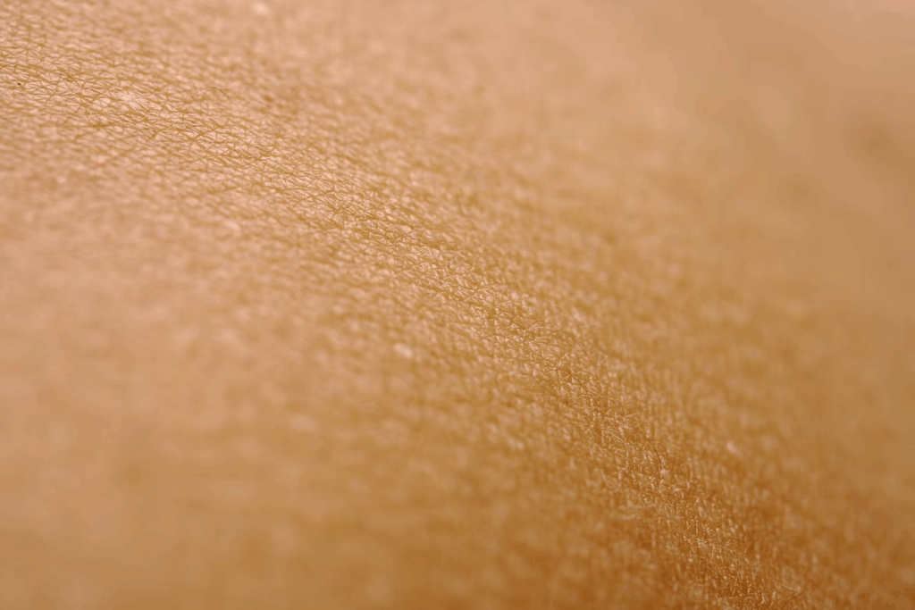 skin