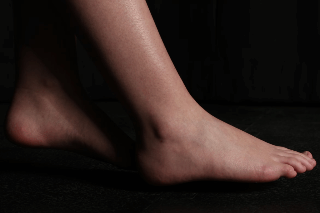 swollen ankles