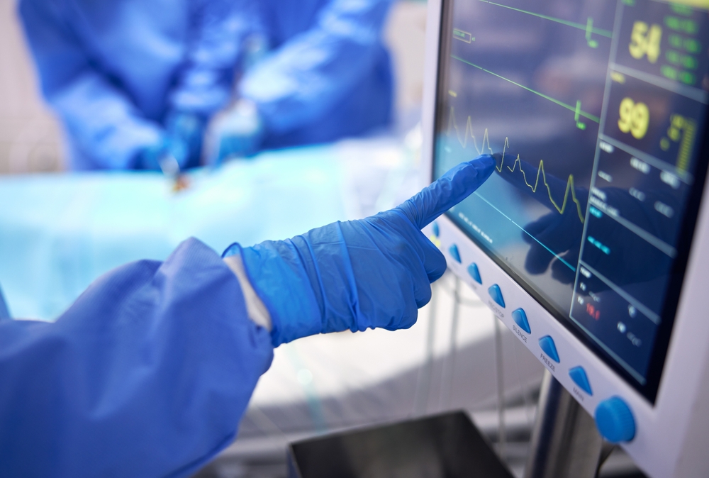 Nurse, monitor and electrocardiogram in surgery, cardiology and check on vitals in operation. Doctor, healthcare and procedure with medical equipment for cardiovascular health, screen and hospital