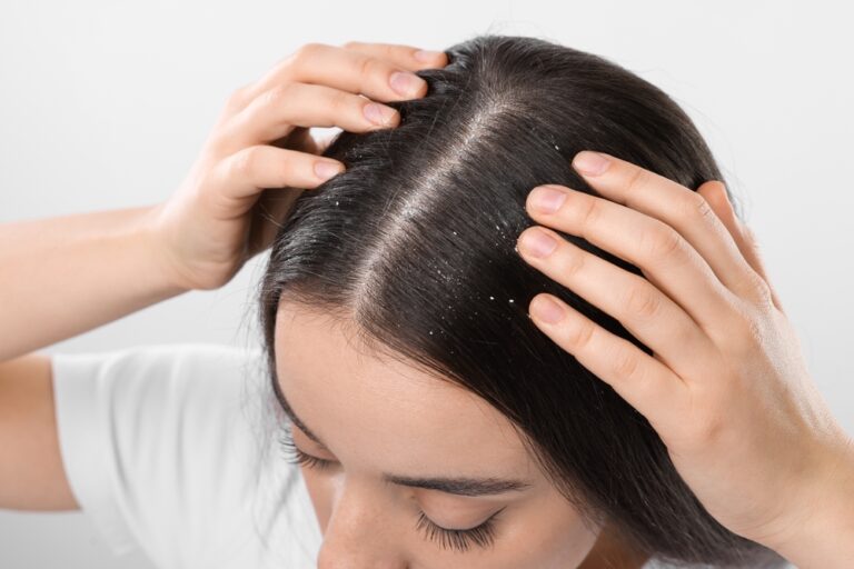 Little Known Vitamin Deficiencies That Show Up On Your Skin - Featured image