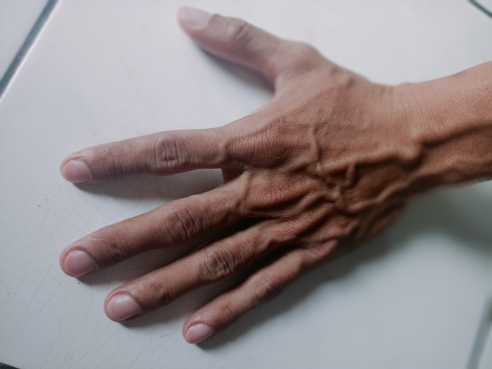 Clubbing finger, low oxygen received