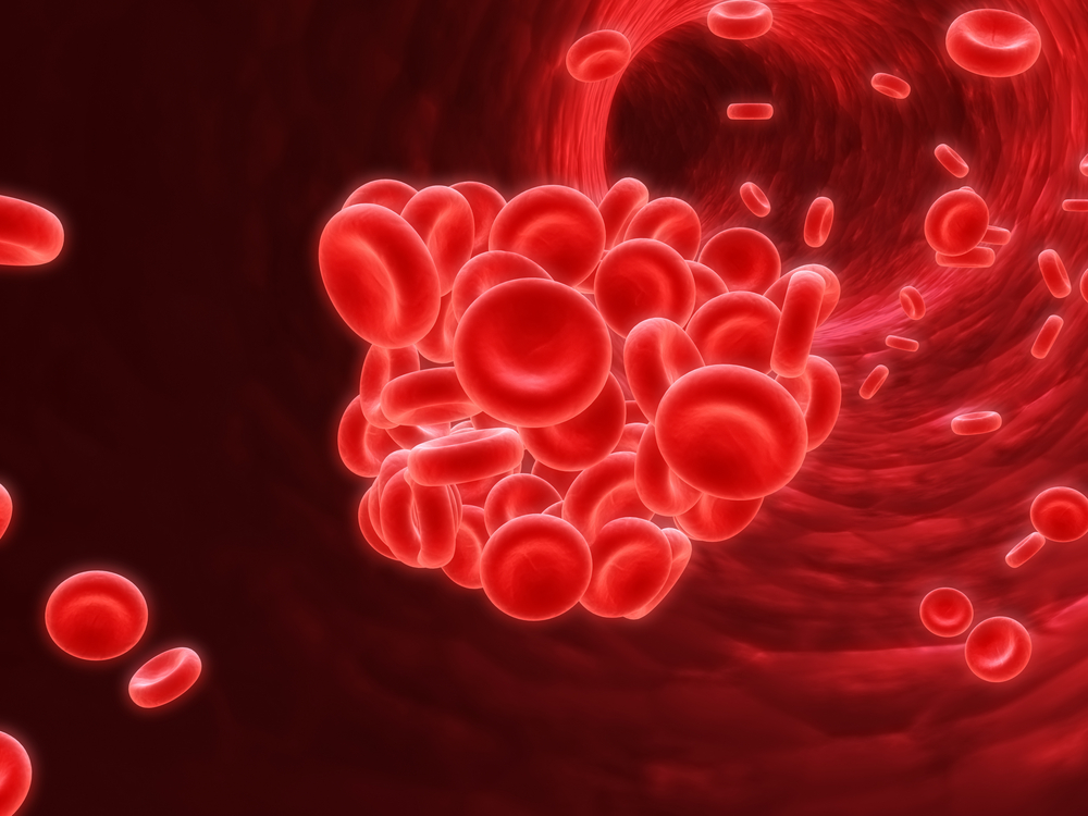 blood clot