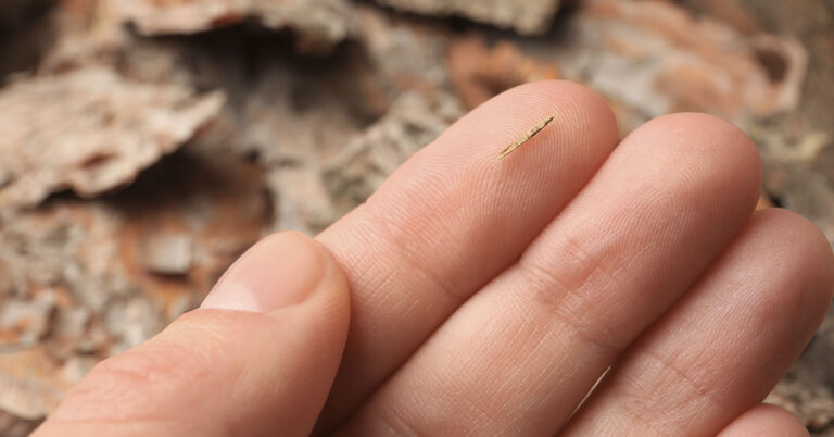 9 Easy At-Home Methods to Remove Splinters Safely - Featured image
