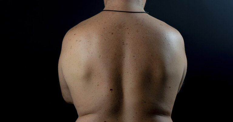 8 Health Red Flags Every Man in Midlife Should Watch Out For - Featured image