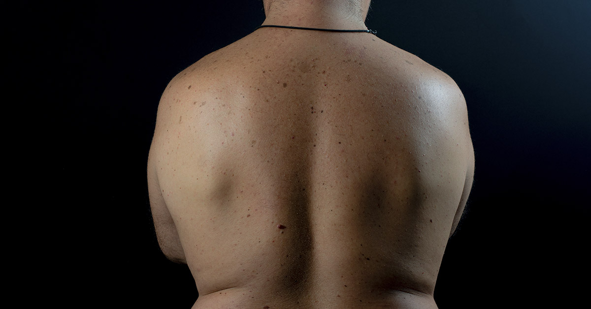 8 Health Red Flags Every Man in Midlife Should Watch Out For