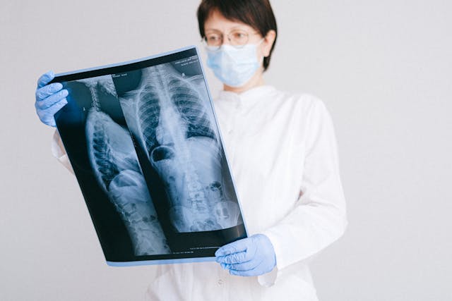 x-rays of lungs