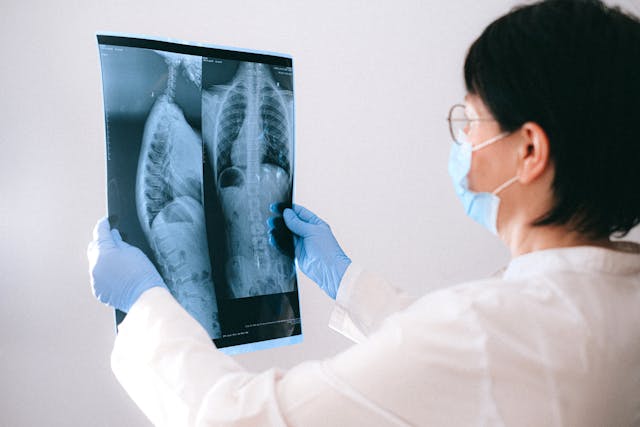 doctor holding x-ray