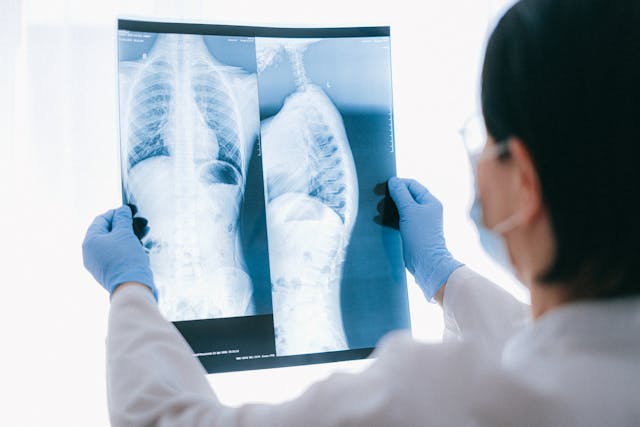 an x-ray of lungs