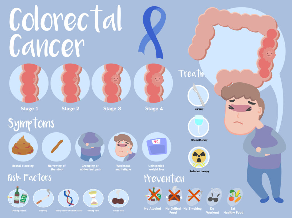 Colorectal Cancer infographic