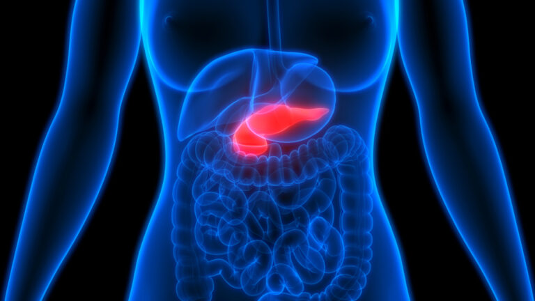 Pancreatic Cancer Risk Factors: What the Latest Research Actually Shows - Featured image
